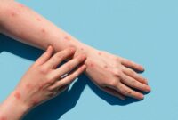 sumber foto: asset.kompas.com