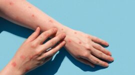 sumber foto: asset.kompas.com