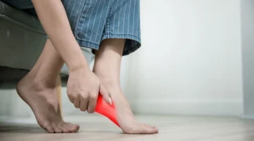 Kisah Bu Tri Cahyani Mengurangi Nyeri Plantar Fasciitis dengan Terapi Biosaka